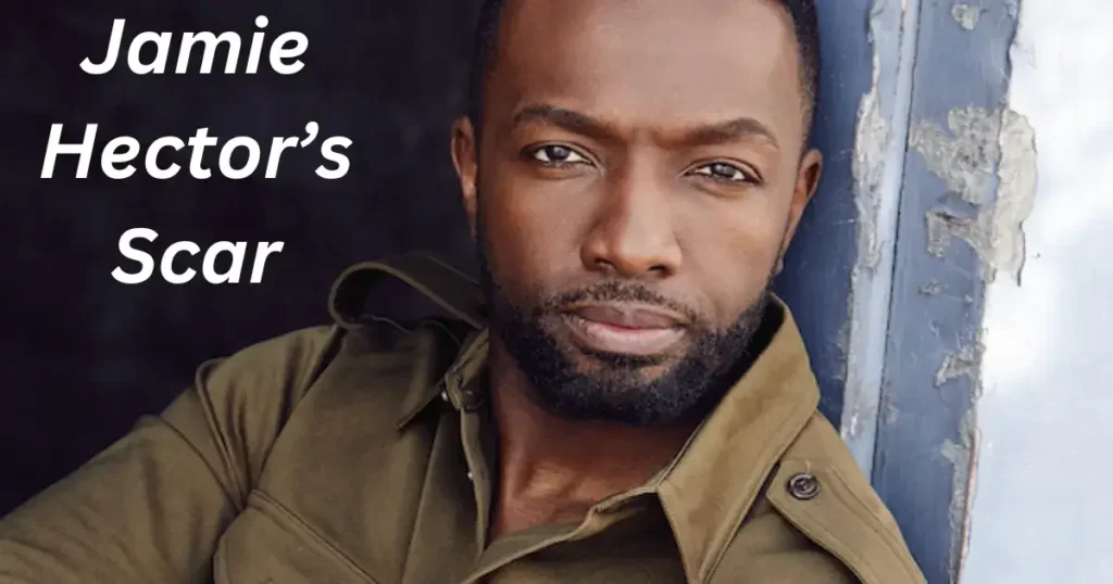 Understanding Jamie Hector’s Scar: A Journey of Resilience